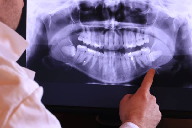 Best Tooth Infection Emergency Dentist  in Blair, WI